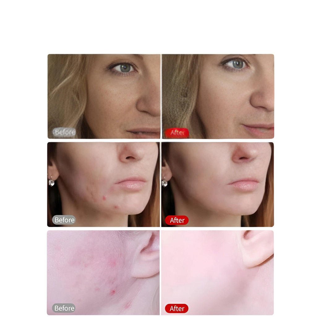 LED Light Therapy Mask for radiant skin