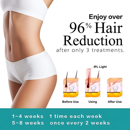 BoSidin D-1129 IPL Hair Removal Device with Ice-Cool Head